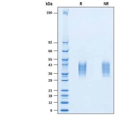 2 μg/lane of Recombinant Cynomolgus Monkey VISTA/B7-H5/PD-1H His-tag Protein (Catalog # 10473-B7) was resolved with SDS-PAGE under reducing (R) and non-reducing (NR) conditions and visualized by Coomassie® Blue staining, showing bands at 35-45 kDa.