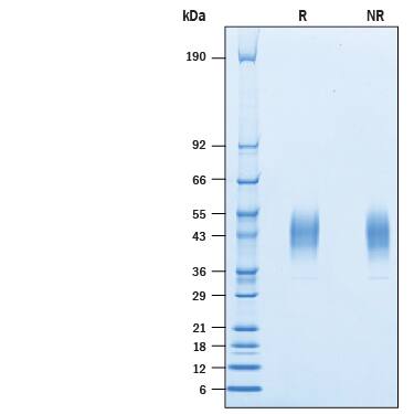 2 μg/lane of Biotinylated Recombinant Human VISTA/B7-H5/PD-1H His-tag Avi-tag (Catalog # AVI9057) was resolved with SDS-PAGE under reducing (R) and non-reducing (NR) conditions and visualized by Coomassie® Blue staining, showing bands at 35-50 kDa.