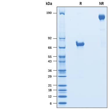 2 μg/lane of Biotinylated Recombinant Human VSIG4 Fc Chimera Avi-tag (Catalog # AVI4646) was resolved with SDS-PAGE under reducing (R) and non-reducing (NR) conditions and visualized by Coomassie® Blue staining, showing bands at 65-85 kDa and 130-170 kDa.