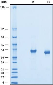 2 μg/lane of Recombinant Mouse VSTM2A was resolved with SDS-PAGE under reducing (R) and non-reducing (NR) conditions and visualized by Coomassie® Blue staining, showing bands at 35-44 kDa.