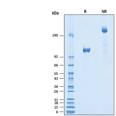 2 μg/lane of Recombinant Human Vasorin/SLIT-like 2 Fc Chimera (Catalog # 10139-VN) was resolved with SDS-PAGE under reducing (R) and non-reducing (NR) conditions and visualized by Coomassie® Blue staining, showing bands at 106-120 kDa and 220-240 kDa, respectively.