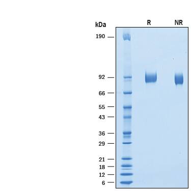 2 μg/lane of Recombinant Human Vasorin/SLIT-like 2 His-tag (Catalog # 10156-VN) was resolved with SDS-PAGE under reducing (R) and non-reducing (NR) conditions and visualized by Coomassie® Blue staining, showing bands at 83-95 kDa.