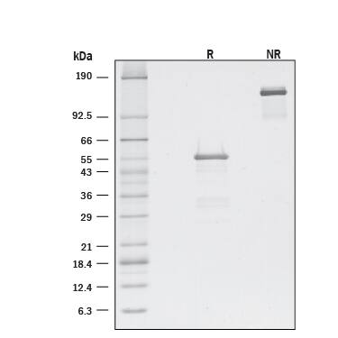 1 μg/lane of Recombinant Mouse ZNRF3(Catalog # 8328-RF) was resolved with SDS-PAGE under reducing (R) and non-reducing (NR) conditions and visualized by silver staining, showing bands at 54.7 and 138 kDa, respectively.