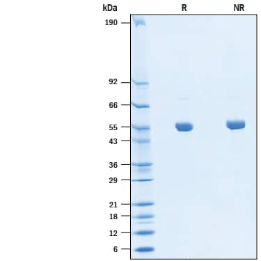 2 μg/lane of Biotinylated Recombinant SARS-CoV-2 Nucleocapsid His-tag Protein (Catalog # BT10474) was resolved with SDS-PAGE under reducing (R) and non-reducing (NR) conditions and visualized by Coomassie® Blue staining, showing bands at 49-59 kDa.