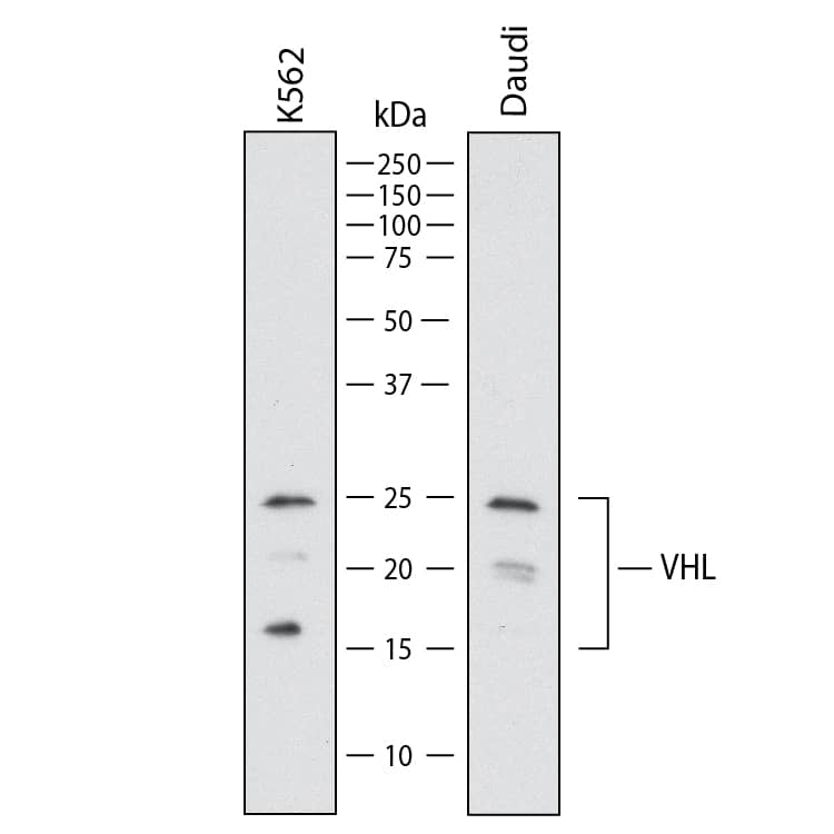 Western blot shows lysates of K562 human chronic myelogenous leukemia cells and Daudi human Burkitt's lymphoma cells. PVDF membrane was probed with 2 µg/mL of Mouse Anti-Human VHL Monoclonal Antibody (Catalog # MAB11435) followed by HRP-conjugated Anti-Mouse IgG Secondary Antibody (Catalog # HAF018). Specific bands were detected for VHL at approximately 17, 24 kDa (as indicated). This experiment was conducted under reducing conditions and using Western Blot Buffer Group 1.