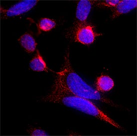 TSG101 was detected in immersion fixed SW480 Human Colorectal Adenocarcinoma Cells using Mouse Anti-Human TSG101 Monoclonal Antibody (Catalog # MAB11438) at 8 µg/mL for 3 hours at room temperature. Cells were stained using the NorthernLights™ 557-conjugated Anti-Mouse IgG Secondary Antibody (red; Catalog # NL007) and counterstained with DAPI (blue). Specific staining was localized to cell cytoplasm. View our protocol for Fluorescent ICC Staining of Cells on Coverslips.