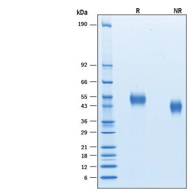 2 μg/lane of Recombinant Human uPAR His-tag Avi-tag (Catalog # AVI807) was resolved with SDS-PAGE under reducing (R) and non-reducing (NR) conditions and visualized by Coomassie® Blue staining, showing bands at 47-54 kDa.