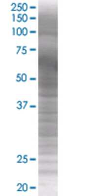 TRIM23 transfected lysate.