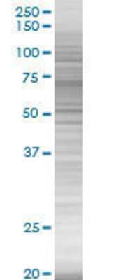 SERPING1 transfected lysate.