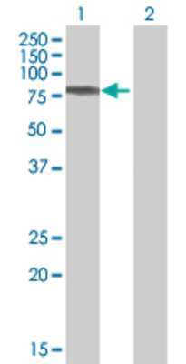 Lane 1: SERPING1 transfected lysate (55.2 KDa) Lane 2: Non-transfected lysate.