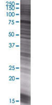 CAPN5 transfected lysate.