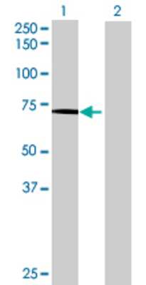 Lane 1: CAPN5 transfected lysate (70.51 KDa) Lane 2: Non-transfected lysate.