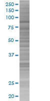 CALD1 transfected lysate.