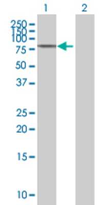 Lane 1: CALD1 transfected lysate (62.7 KDa) Lane 2: Non-transfected lysate.
