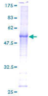 12.5% SDS-PAGE Stained with Coomassie Blue.