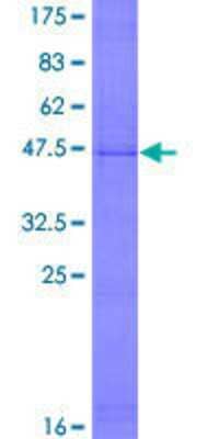 12.5% SDS-PAGE Stained with Coomassie Blue.