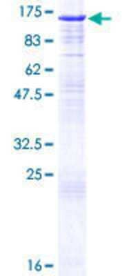 12.5% SDS-PAGE Stained with Coomassie Blue.