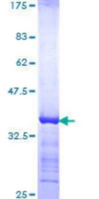 12.5% SDS-PAGE Stained with Coomassie Blue.