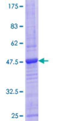 12.5% SDS-PAGE Stained with Coomassie Blue.