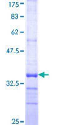 SDS-Page: Recombinant Human CD3 delta Protein [H00000915-Q01] - 12.5% SDS-PAGE Stained with Coomassie Blue.