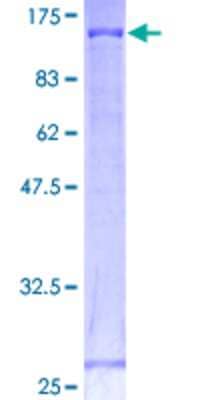 SDS-Page: Recombinant Human Cadherin-18 Protein [H00001016-P01] - 12.5% SDS-PAGE Stained with Coomassie Blue.