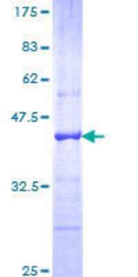 12.5% SDS-PAGE Stained with Coomassie Blue.