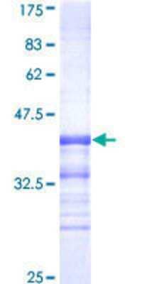 12.5% SDS-PAGE Stained with Coomassie Blue.