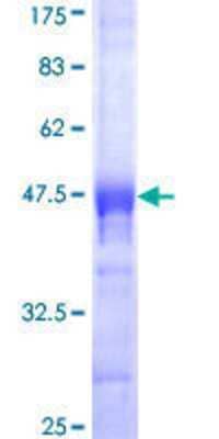 SDS-Page: Recombinant Human CDX4 Protein [H00001046-Q01] - 12.5% SDS-PAGE Stained with Coomassie Blue.