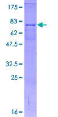 12.5% SDS-PAGE Stained with Coomassie Blue.