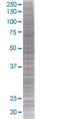 CGB transfected lysate