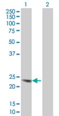 Lane 1: CGB transfected lysate (17.7 KDa). Lane 2: Non-transfected lysate.