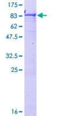 12.5% SDS-PAGE Stained with Coomassie Blue.