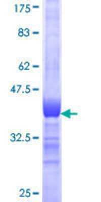 12.5% SDS-PAGE Stained with Coomassie Blue.