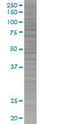 CHD2 transfected lysate.