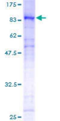 Other Recombinant Human CHES1 GST (N-Term) Protein