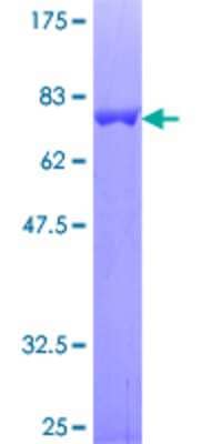 12.5% SDS-PAGE Stained with Coomassie Blue.