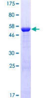 12.5% SDS-PAGE Stained with Coomassie Blue.