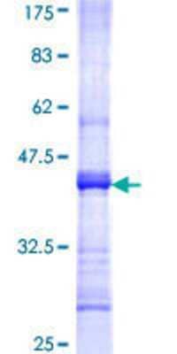 SDS-PAGE Recombinant Human Nicotinic Acetylcholine R alpha 2/CHRNA2 GST (N-Term) Protein