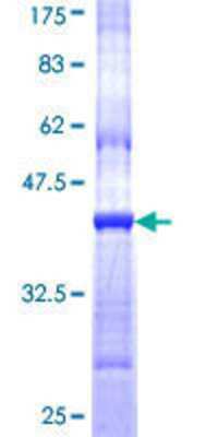 Other Recombinant Human CHRND GST (N-Term) Protein