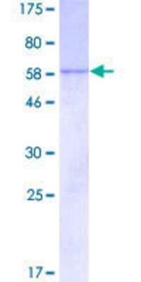 12.5% SDS-PAGE Stained with Coomassie Blue.