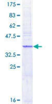 SDS-PAGE Recombinant Human AP1S1 GST (N-Term) Protein