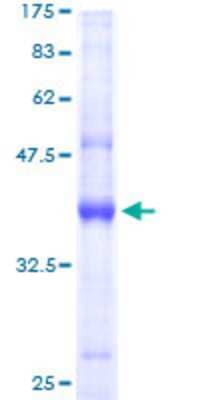 SDS-Page: Recombinant Human AP2S1 Protein [H00001175-P01] - 12.5% SDS-PAGE Stained with Coomassie Blue.