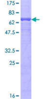 SDS-Page: Recombinant Human CLCN2 Protein [H00001181-P01] - 12.5% SDS-PAGE Stained with Coomassie Blue.