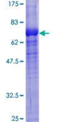 12.5% SDS-PAGE Stained with Coomassie Blue.