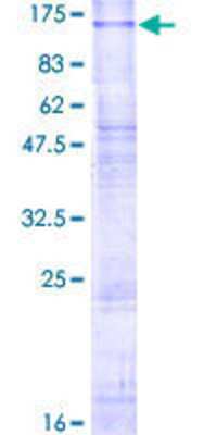SDS-Page: Recombinant Human CLCN6 Protein [H00001185-P01] - 12.5% SDS-PAGE Stained with Coomassie Blue.