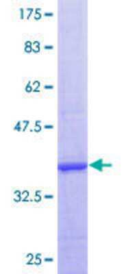 12.5% SDS-PAGE Stained with Coomassie Blue.
