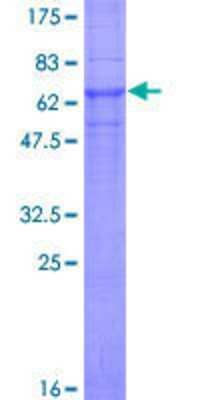 12.5% SDS-PAGE Stained with Coomassie Blue.