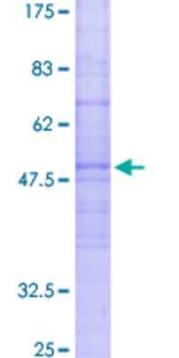SDS-Page: Recombinant Human CC Chemokine Receptor D6 Protein [H00001238-P01] - 12.5% SDS-PAGE Stained with Coomassie Blue.