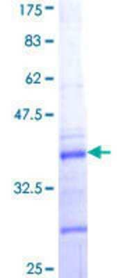 SDS-Page: Recombinant Human Collagen V alpha 2 Protein [H00001290-Q01] - 12.5% SDS-PAGE Stained with Coomassie Blue.