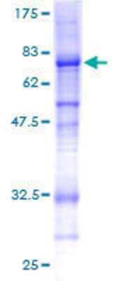 12.5% SDS-PAGE Stained with Coomassie Blue.